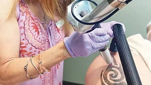 2019-2024-cü illər arasında 1 milyon tatu silindi