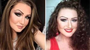 Siqaret çəkərkən saçları alovlanan qadın dünyasını dəyişdi