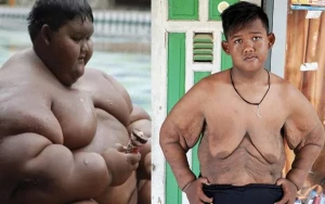 Dünyanın ən kök oğlanı belə çəki itirdi - Foto