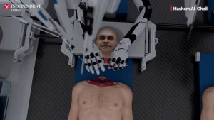 Tibbdə YENİLİK! İnsan başı başqa bədənə köçürüləcək: Görün necə- VİDEO