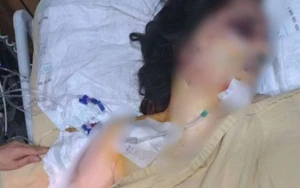 Kişi balta və armaturla həyat yoldaşını ölümcül döydü