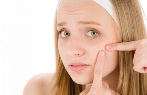 Bu qidalar üzdə sızanaq yaradır -&nbsp;Dermatoloqlardan xəbərdarlıq