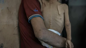Qəzza Zolağında son 24 saatda aclıqdan 5 nəfər öldü