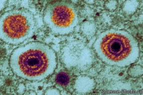 Alimlər yeni təhlükəli virus aşkarladı