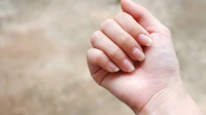 DİQQƏTLİ OLUN! Dırnağınızdakı bu ləkələr xəstəlikdən xəbər verir&nbsp;