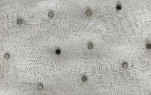 3 yaşlı uşağın qida borusundan 19 maqnit çıxarıldı-FOTO