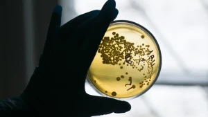 Yeni epidemiya CAN ALDI - Sürətlə yayılır