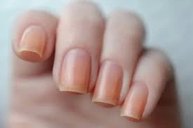 Dırnaqlarınız saralırsa, bunları edin