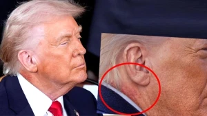 Trampın boynundakı ləkə nə idi? - Həkimi danışdı