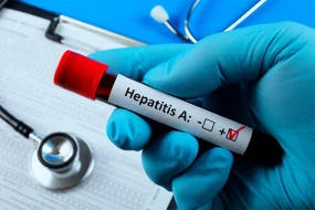 Türkiyədə Hepatit A vaksini istehsal olundu&nbsp;