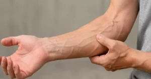 Görünən damarlar hansı xəstəliklərin xəbərçisi ola bilər?