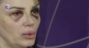 Bakıda mağazada döyülən qadın danışdı: “Demişdi ki, səni doğrayacağam” - VİDEO