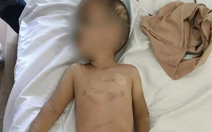 3 yaşlı uşağa zorakılıq etdiyi deyilən ögey atası saxlanıldı